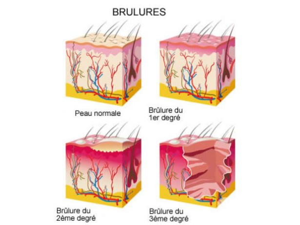 lavanda-extrato-puro-para-queimaduras-pele-ferime-premium-em-sao-paulo-oportunidade-unica-big-3