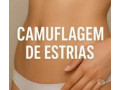 estetica-com-massagem-fazendinha-portao-massagem-premium-em-paranacuritiba-fazendinha-portao-em-paranacuritiba-fazendinha-portao-small-4