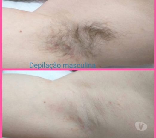 depilacao-massagem-hauer-boqueirao-massagem-e-dr-premium-em-paranacuritiba-boqueirao-em-paranacuritiba-boqueirao-oportunidade-unica-big-2