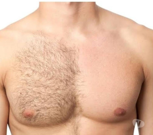 depilacao-exclusiva-masculina-feita-por-homem-sant-paranacuritiba-panta-oportunidade-unica-em-paranacuritiba-panta-condicao-especial-big-1