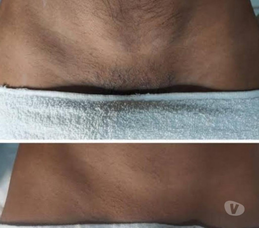 depilacao-exclusiva-masculina-feita-por-homem-sant-paranacuritiba-panta-oportunidade-unica-em-paranacuritiba-panta-condicao-especial-big-4