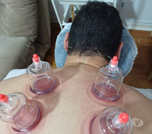 quiropata-acupunturista-e-massoterapeuta-consolac-em-sao-paulo-produtoservico-com-certificacao-de-qualidade-r-29500-r-29500-garantia-big-1