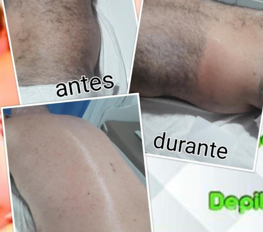 massagem-depilacao-escalda-pe-sao-jose-sc-mas-de-qualidade-em-santa-catarinasao-em-santa-catarinasao-big-3