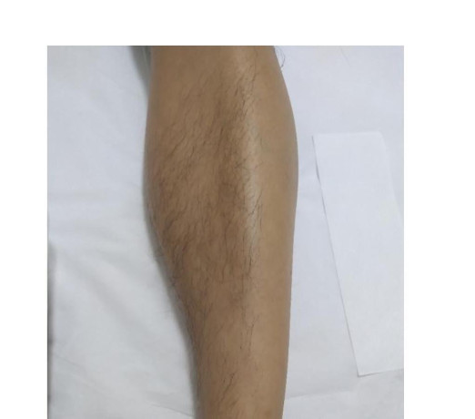 massagem-e-depilacao-vila-mariana-massagem-e-dr-em-sao-paulo-qualidade-garantida-com-otimo-custo-beneficio-big-3