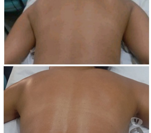 massagem-e-drenagem-linfatica-para-mulheres-outros-sao-paulo-oportunidade-unica-big-3