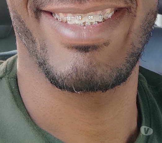 negao-comedor-especialista-senhoras-itapua-orgia-melhor-oferta-bahiasalvador-itapua-em-bahiasalvador-itapua-condicao-especial-big-0